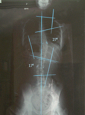 צילום רנטגן בסיום הטיפולים
